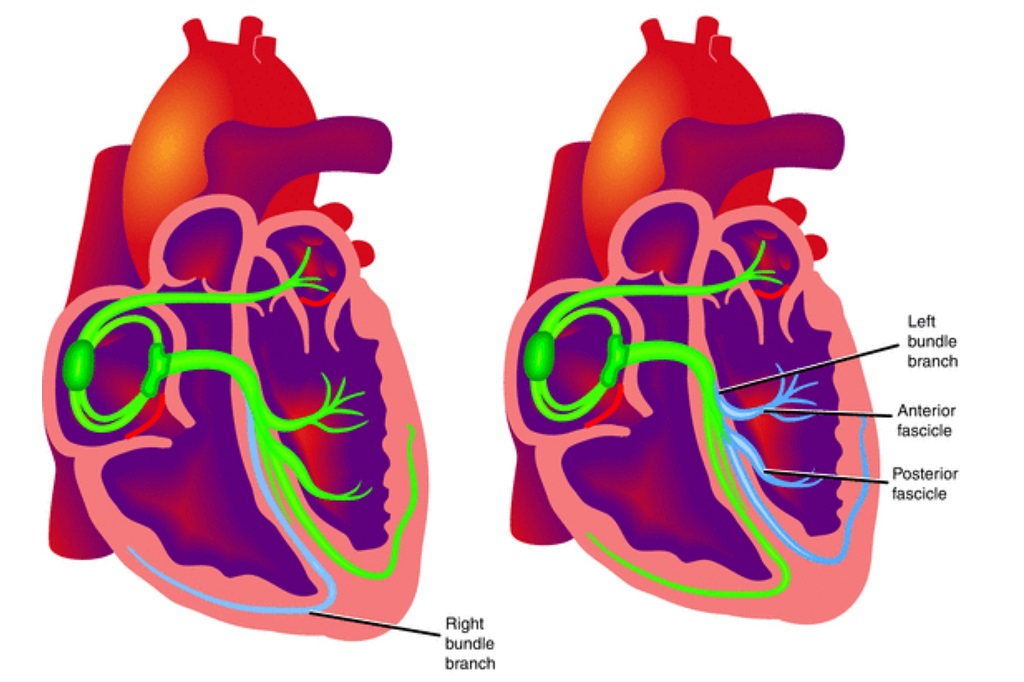 Blocurile de ramură