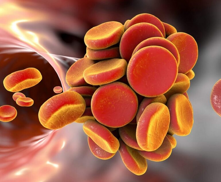 tratamentul anticoagulant