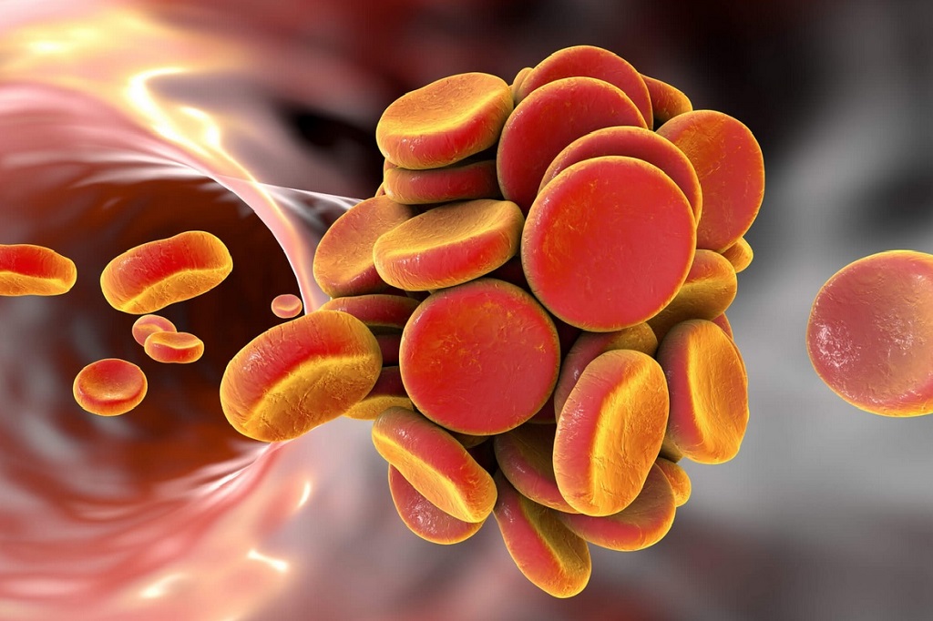 tratamentul anticoagulant